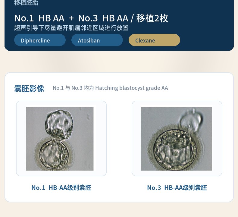45岁患者双胚移植囊胚影像